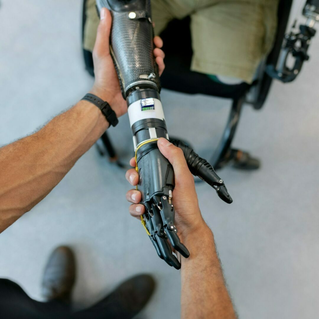 A person with a bionic arm prosthesis is shaking hands with another person as a greeting or in a sign of collaboration.